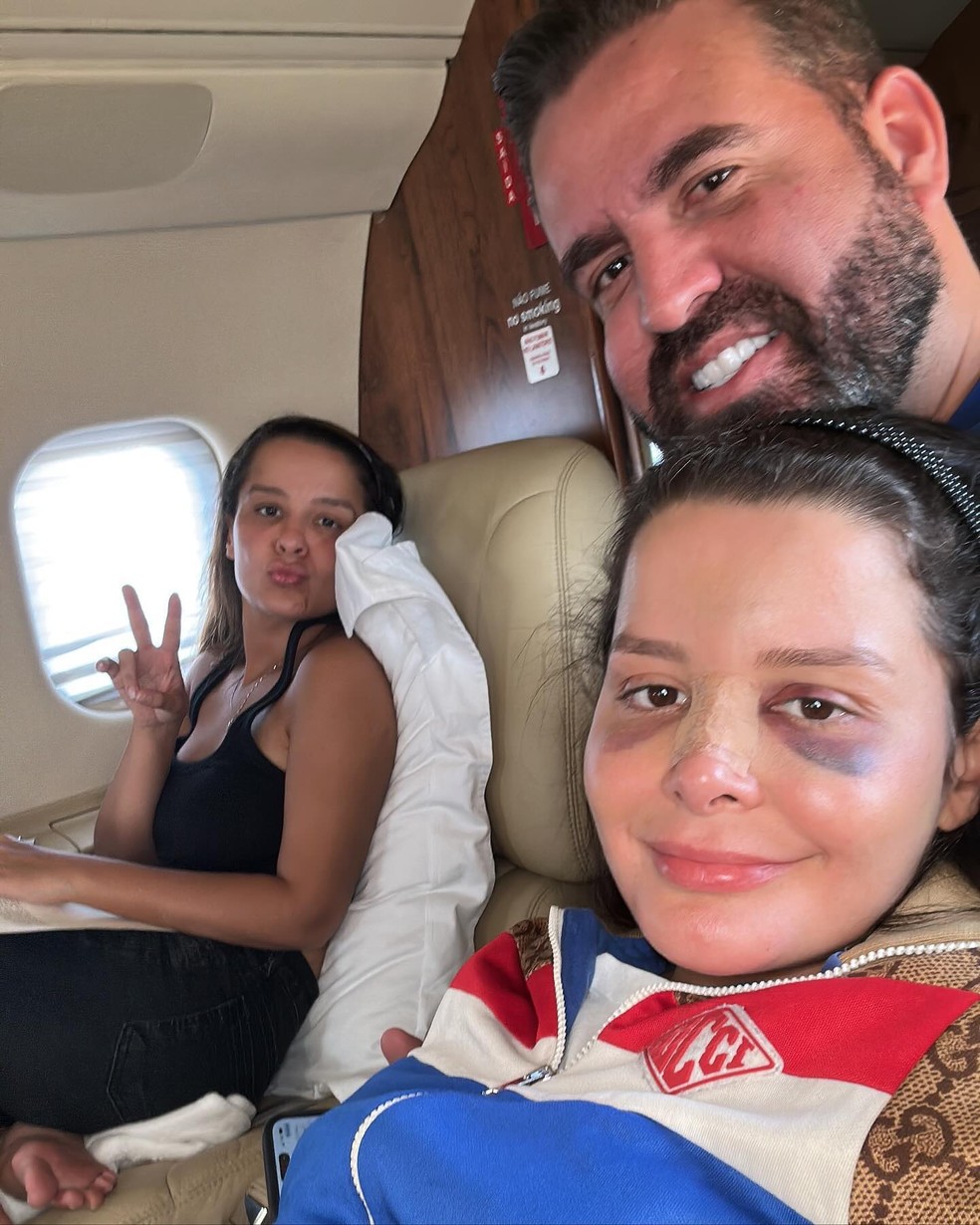 Maraisa tranquiliza f&atilde;s ap&oacute;s acidente em que quebrou o nariz: 'Momentos  conturbados' | TV & Famosos | gshow