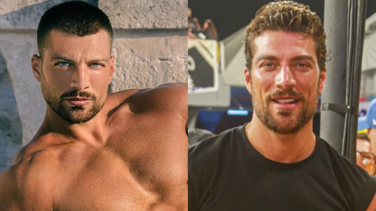 Reconhece? Italiano ex de Anitta mostra novo visual após procedimentos estéticos