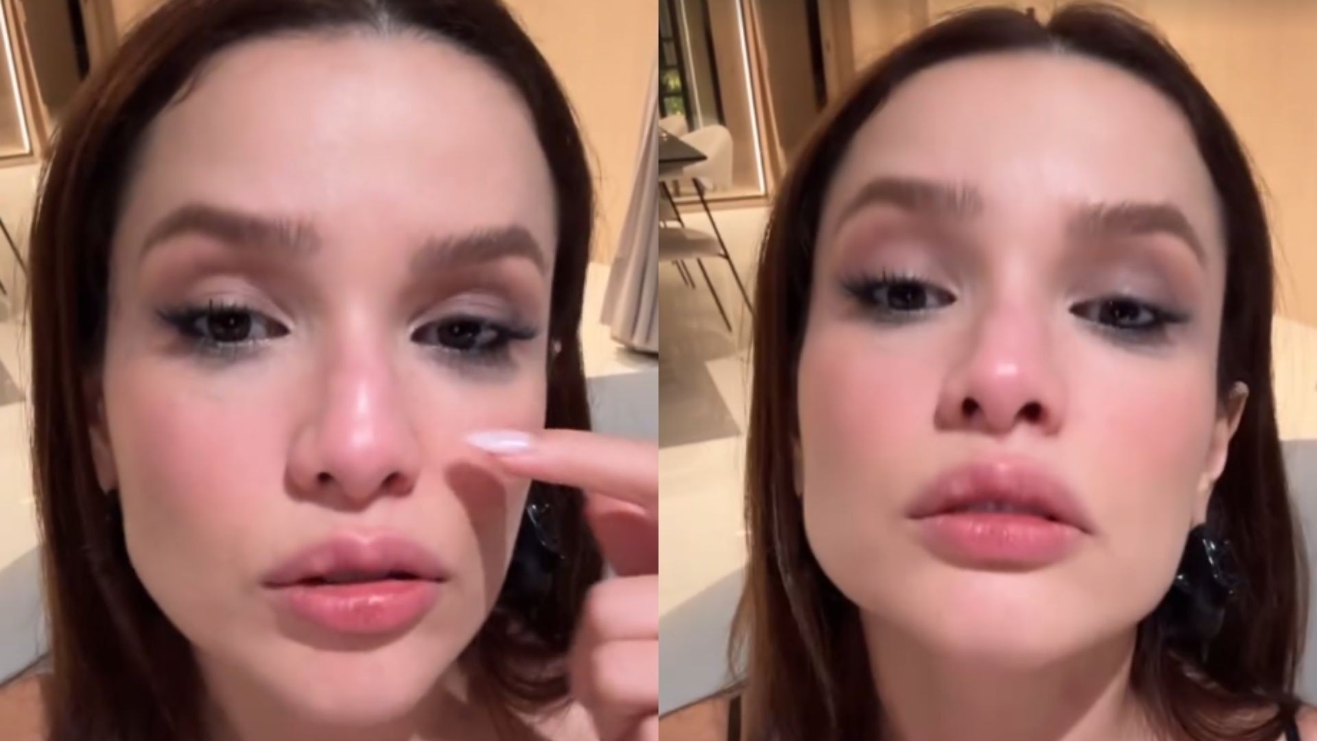 Juliette fratura nariz após bater rosto em porta e lamenta ironizando: 'Que coisa maravilhosa'