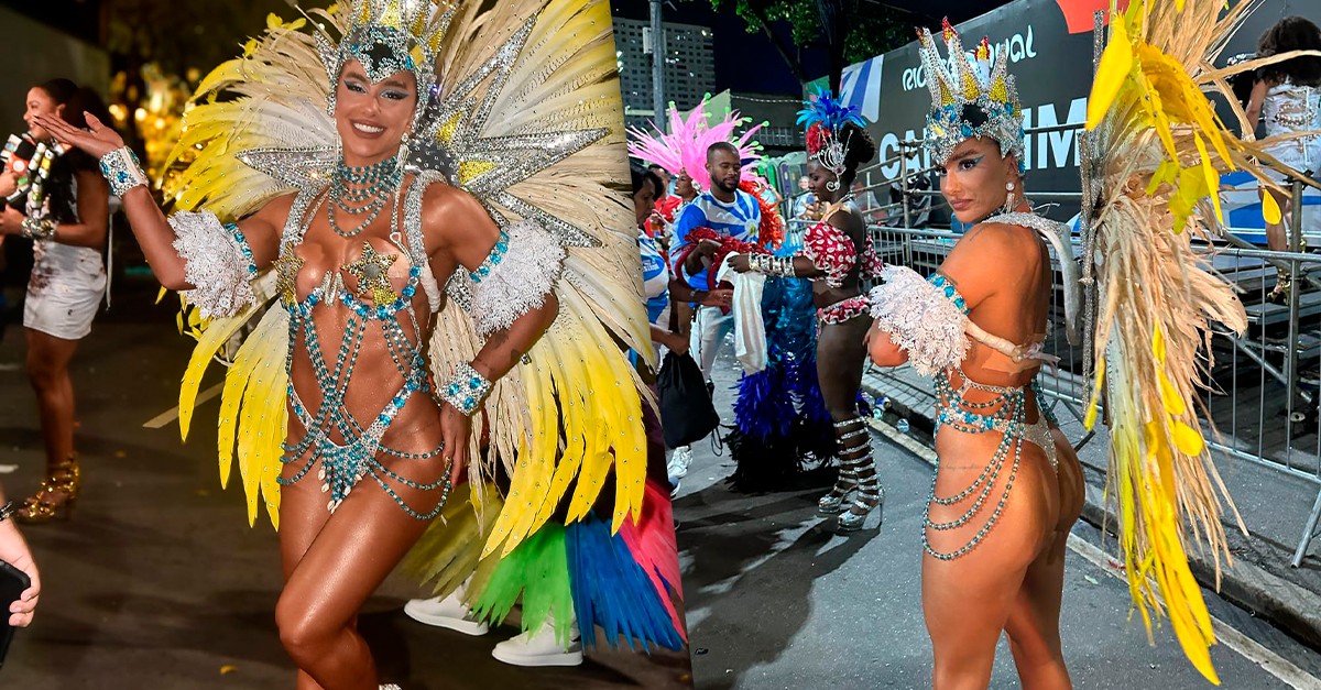 Luiza Caldi revela que harmonizou bumbum para o Carnaval e mostra machucados: 'Arranhada e destruída'