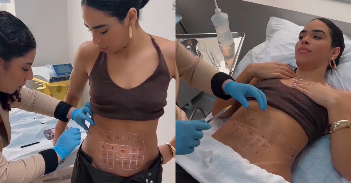 Ex-BBB Elana Valenaria mostra procedimento no abdômen: 'O que mais incomoda'