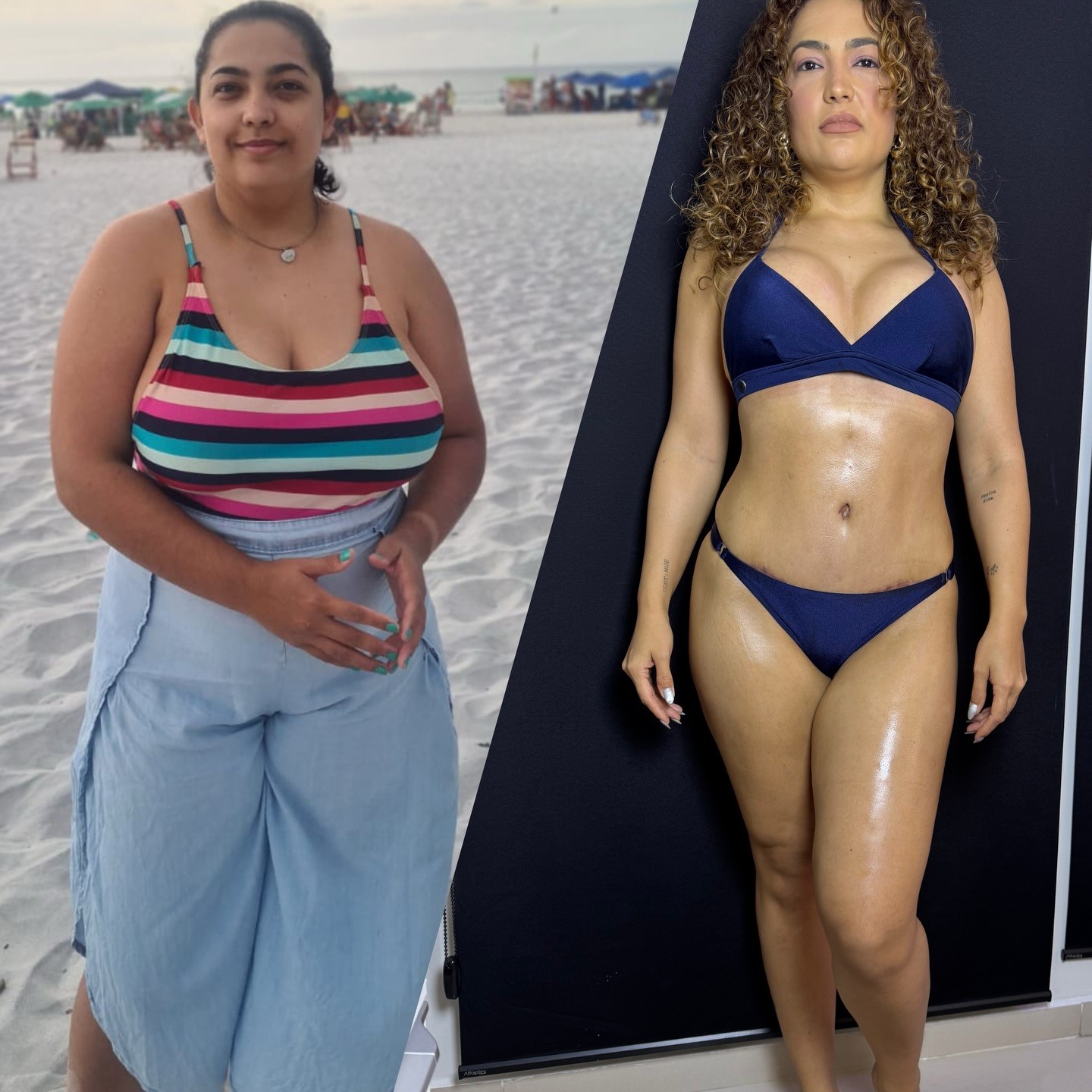 Camila Moura, ex de Lucas Buda, relata luta contra a compulsão alimentar na perda dos 40 kg