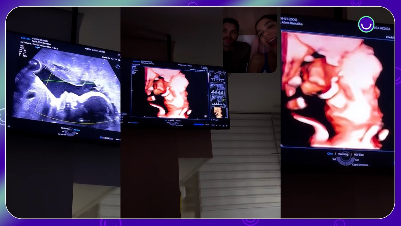 Key Alves mostra rosto da filha Rosamaria em ultrassom: 'Olha o nariz dela'