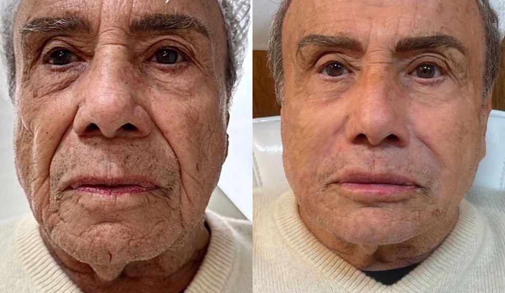 Stênio Garcia — Foto: Instagram