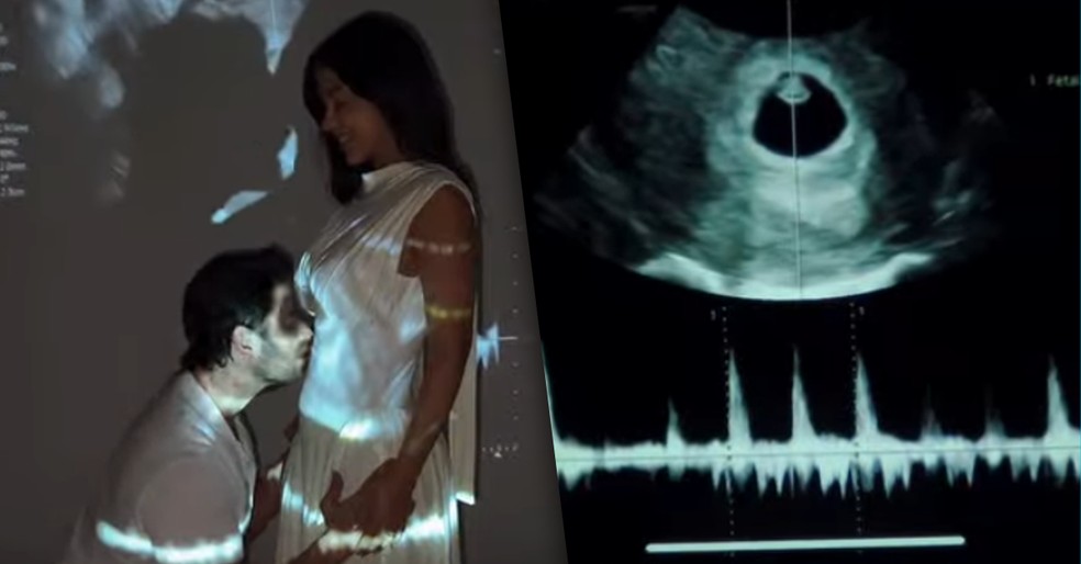 Lais Caldas e Gustavo Marsengo surpreendem e anunciam que estão esperando um filho — Foto: Instagram