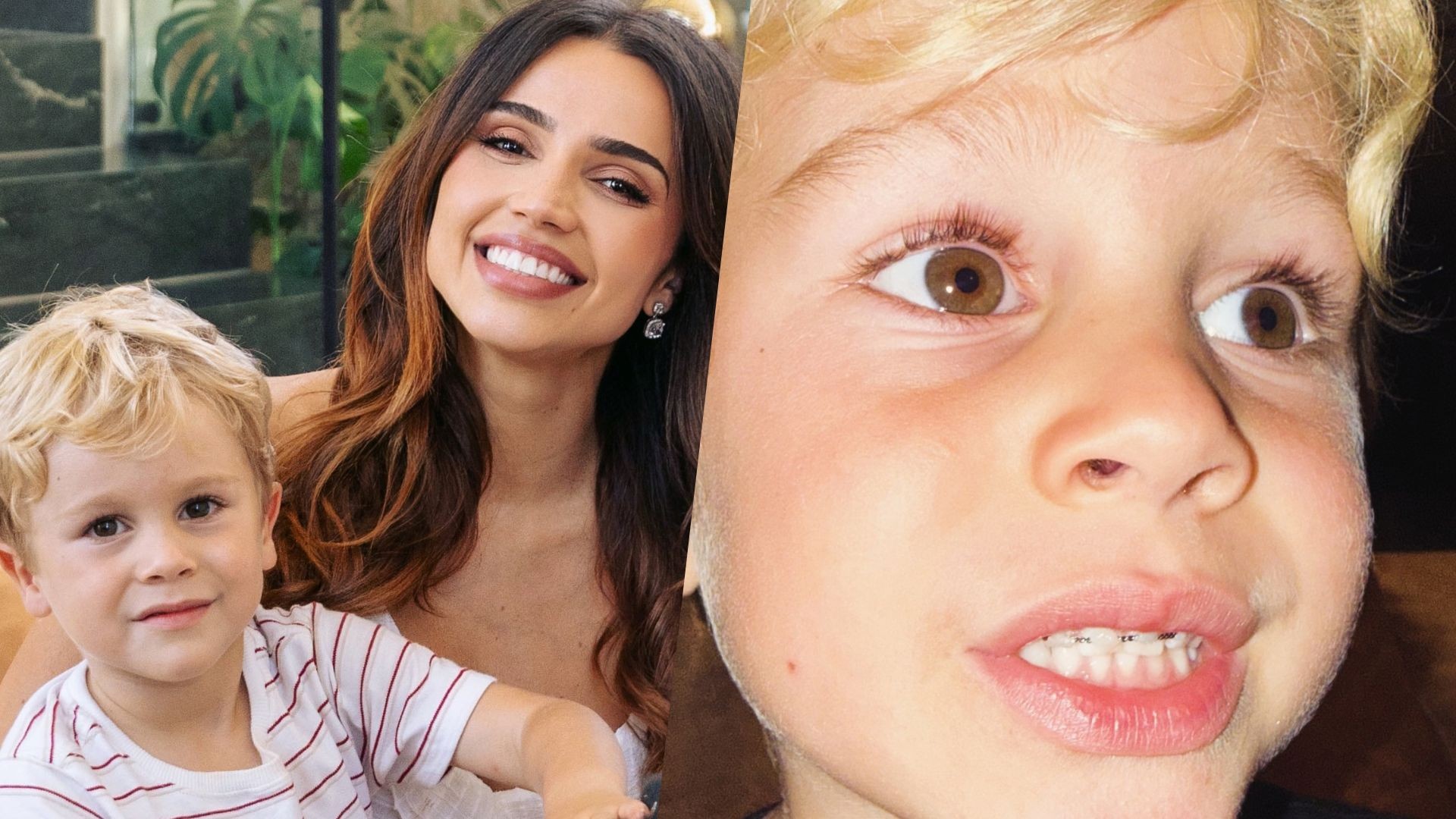 Após levar pontos na mão, filho de Paula Amorim sofre novo acidente e surge com contenção nos dentes: 'Semana do caos'