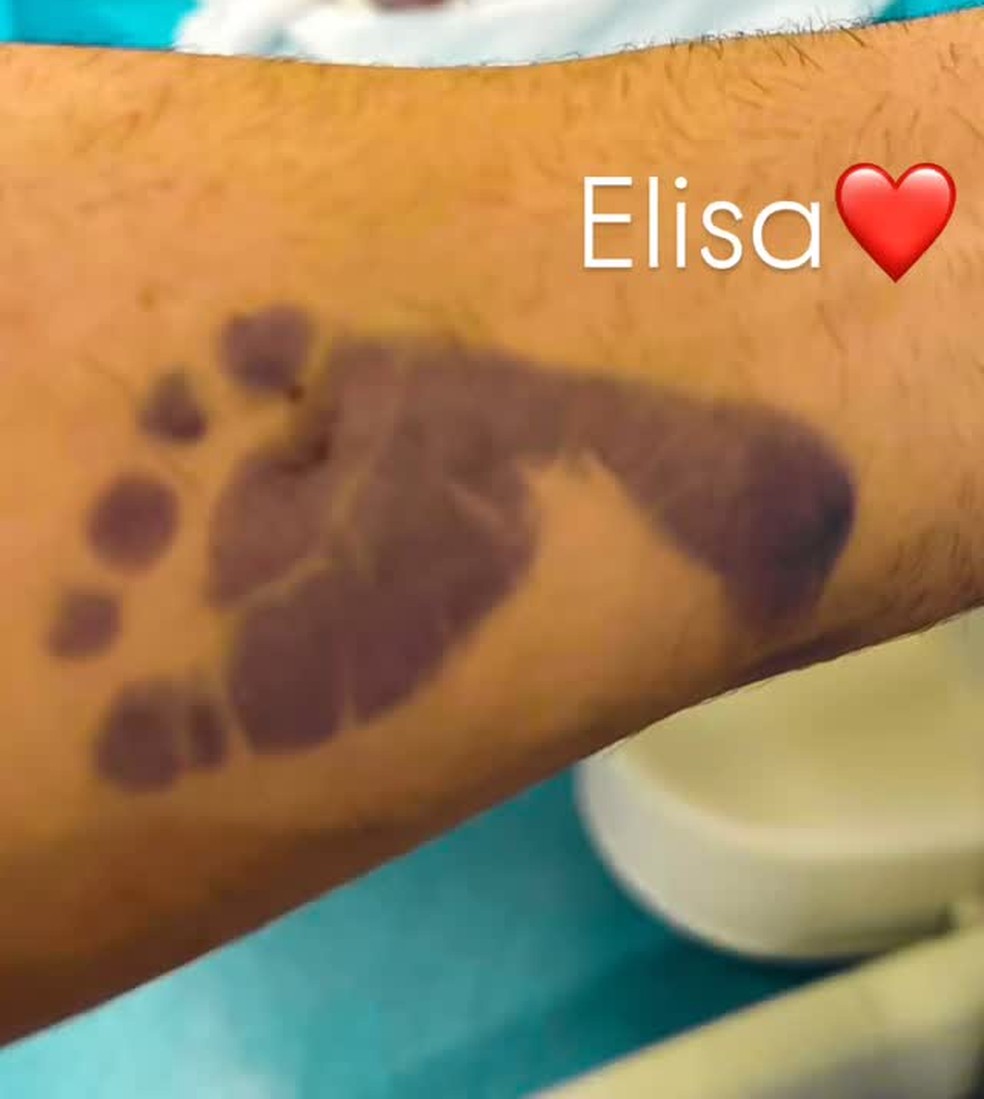 Nasce Elisa, filha do cantor Victor Hugo — Foto: Reprodução/Instagram