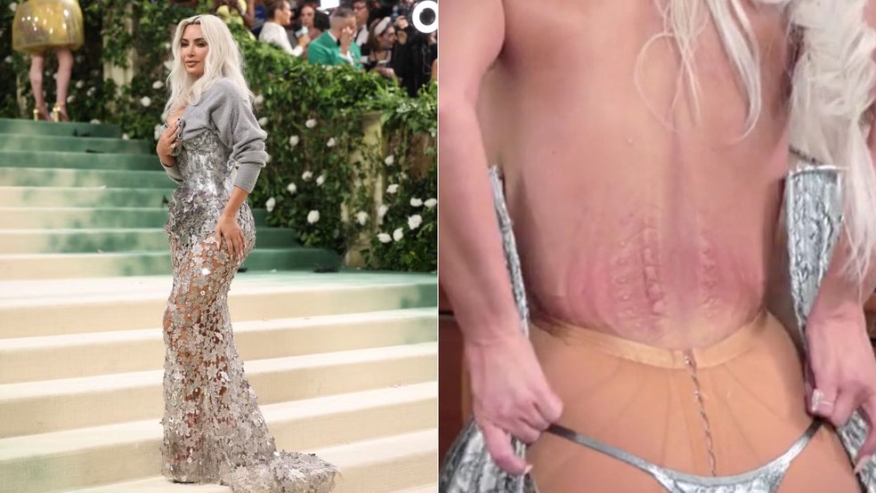 Kim Kardashian mostra marcas deixadas por corset usado no Met Gala de 2024:  'Nunca senti tanta dor' | Moda | gshow