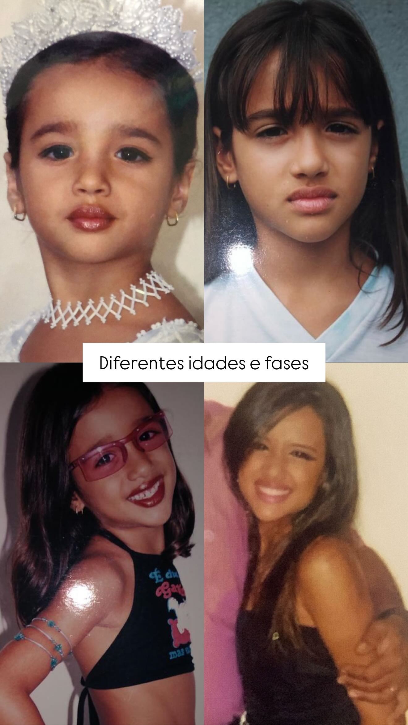 Jordana Morais rebate críticas sobre procedimento estético e relembra bullying: 'Sofria muito'