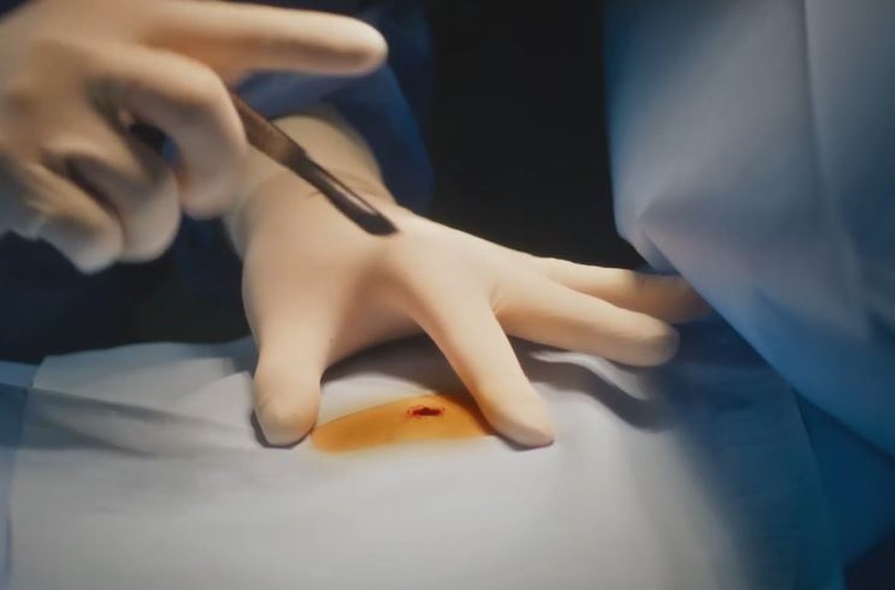 Terra e Paixão: Jonatas é operado e fica entre a vida e a morte após se sacrificar por Aline — Foto: Globo