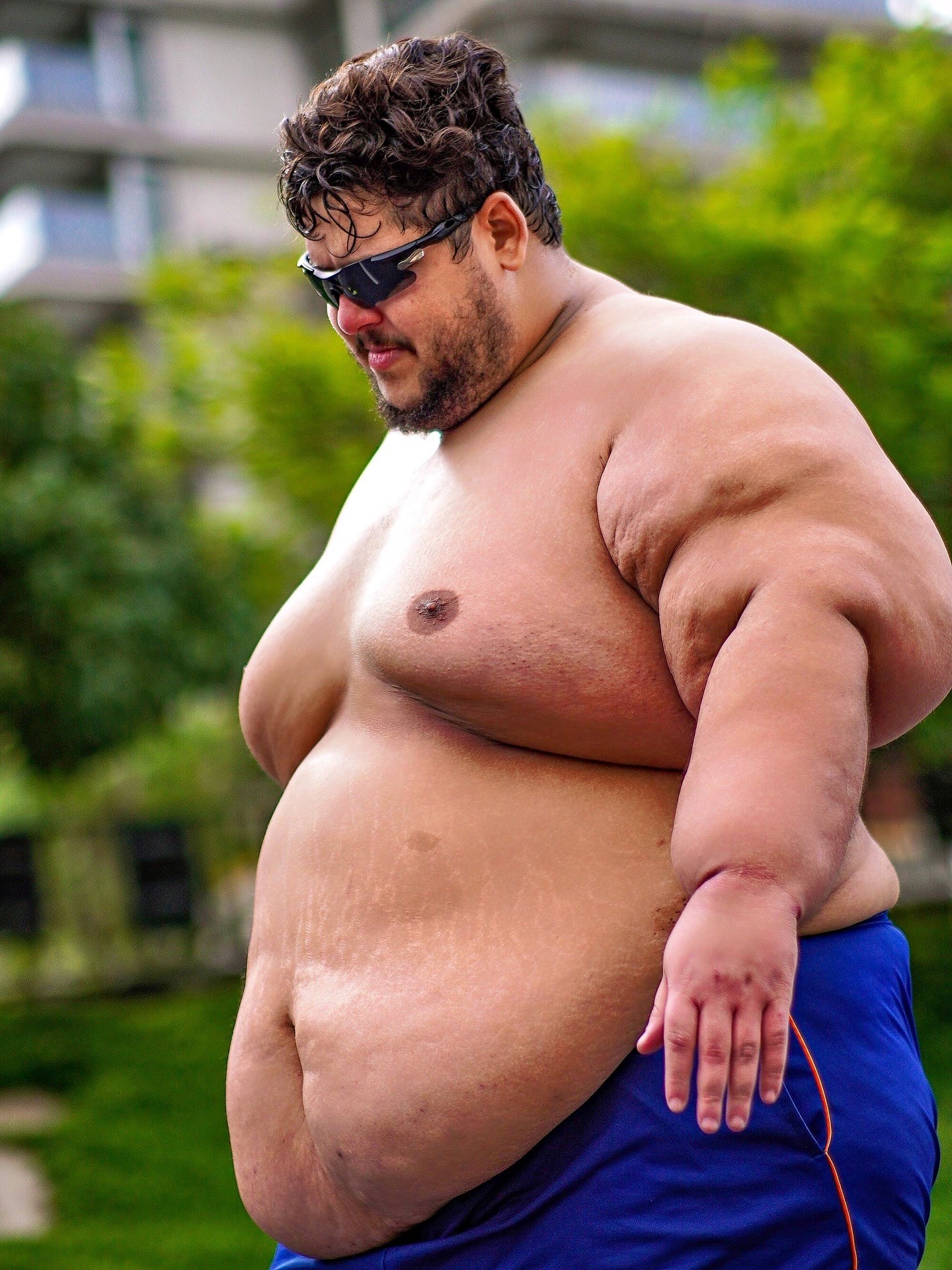 Após pesar 300 kg, influenciador perde 115 Kg e transforma luta em doação: 'A obesidade quase me levou à morte'