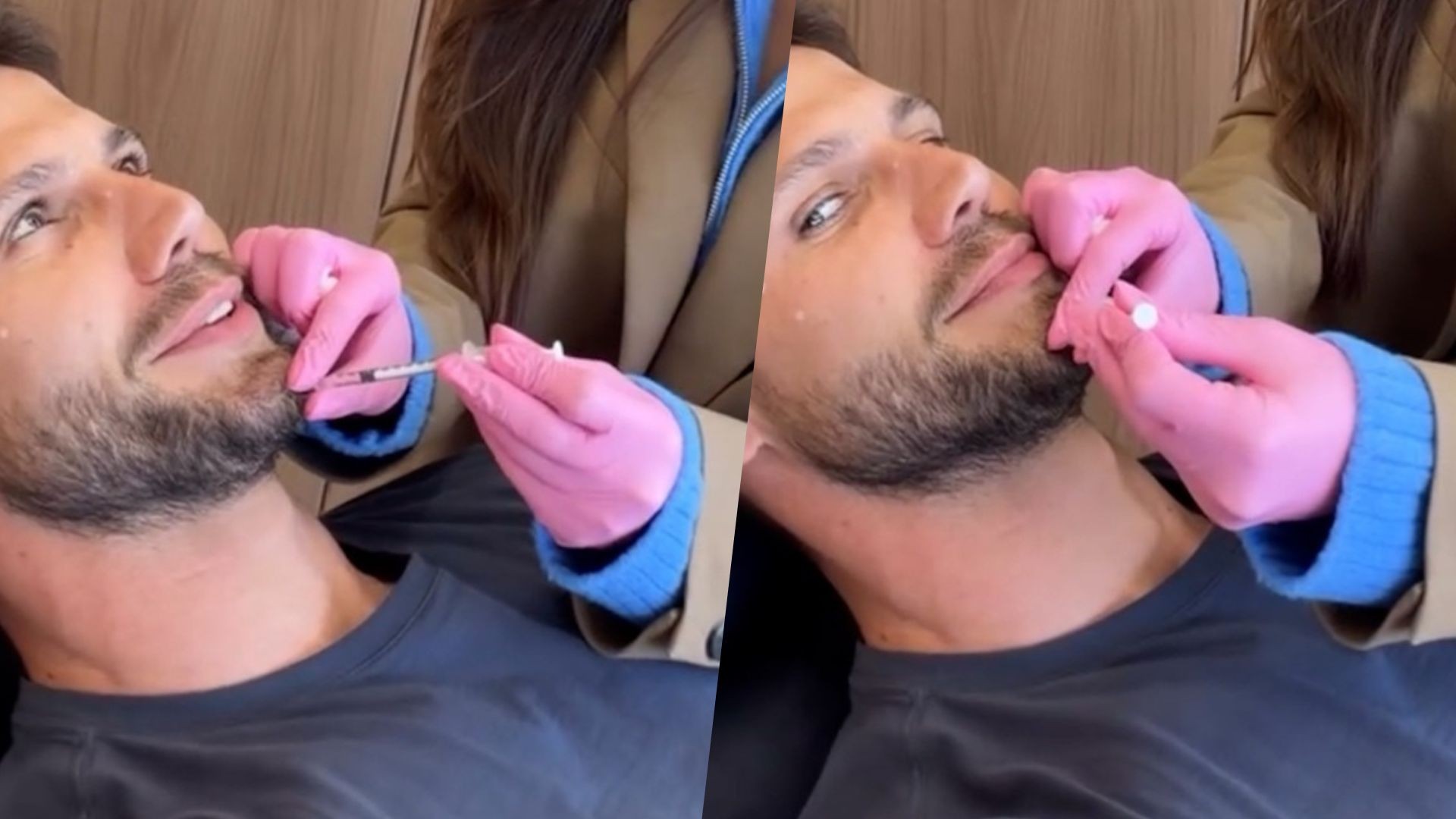 Jonas Sulzbach retoca botox e compartilha procedimento com seguidores; veja
