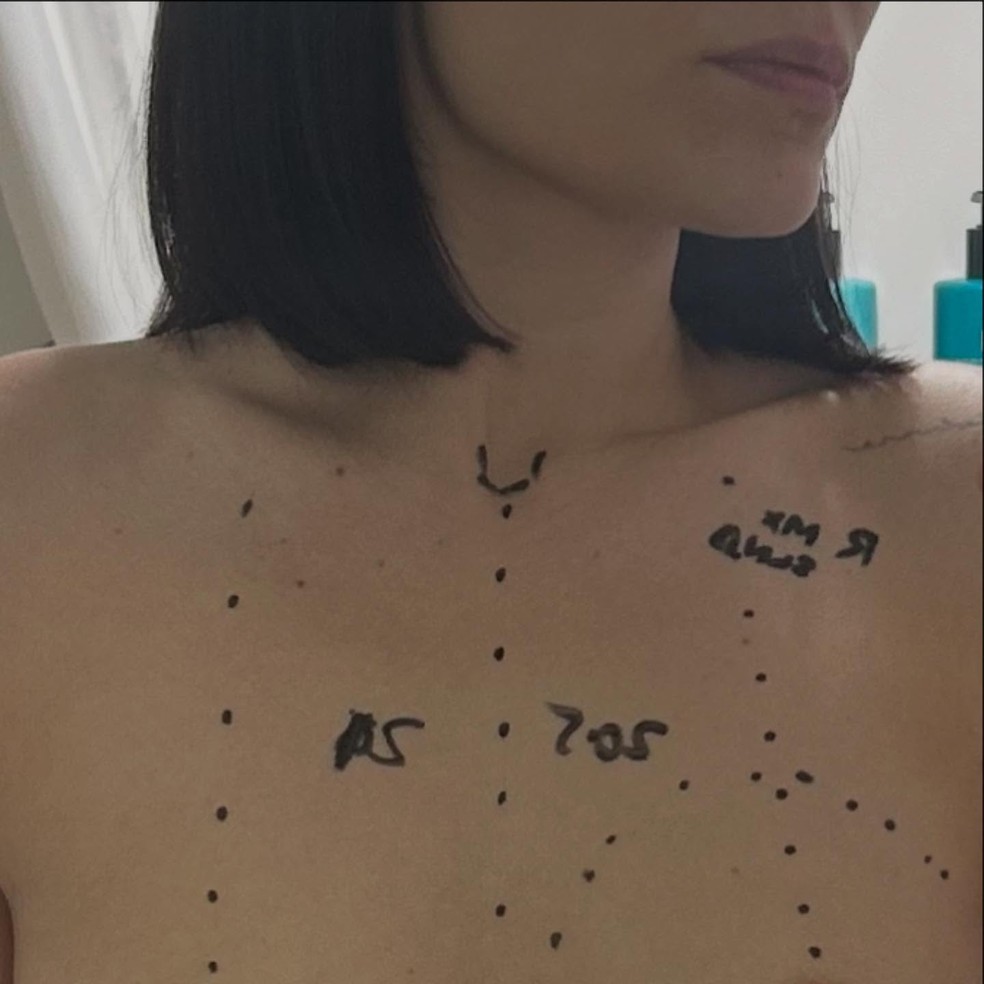 Jessie J mostra tratamento contra câncer de mama no Instagram — Foto: Reprodução/Instagram