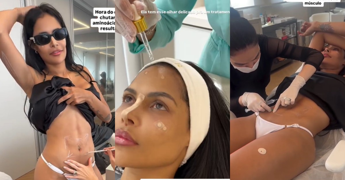 Flay mostra procedimento estético no rosto e nos glúteos: 'Chutar qualquer flacidez'