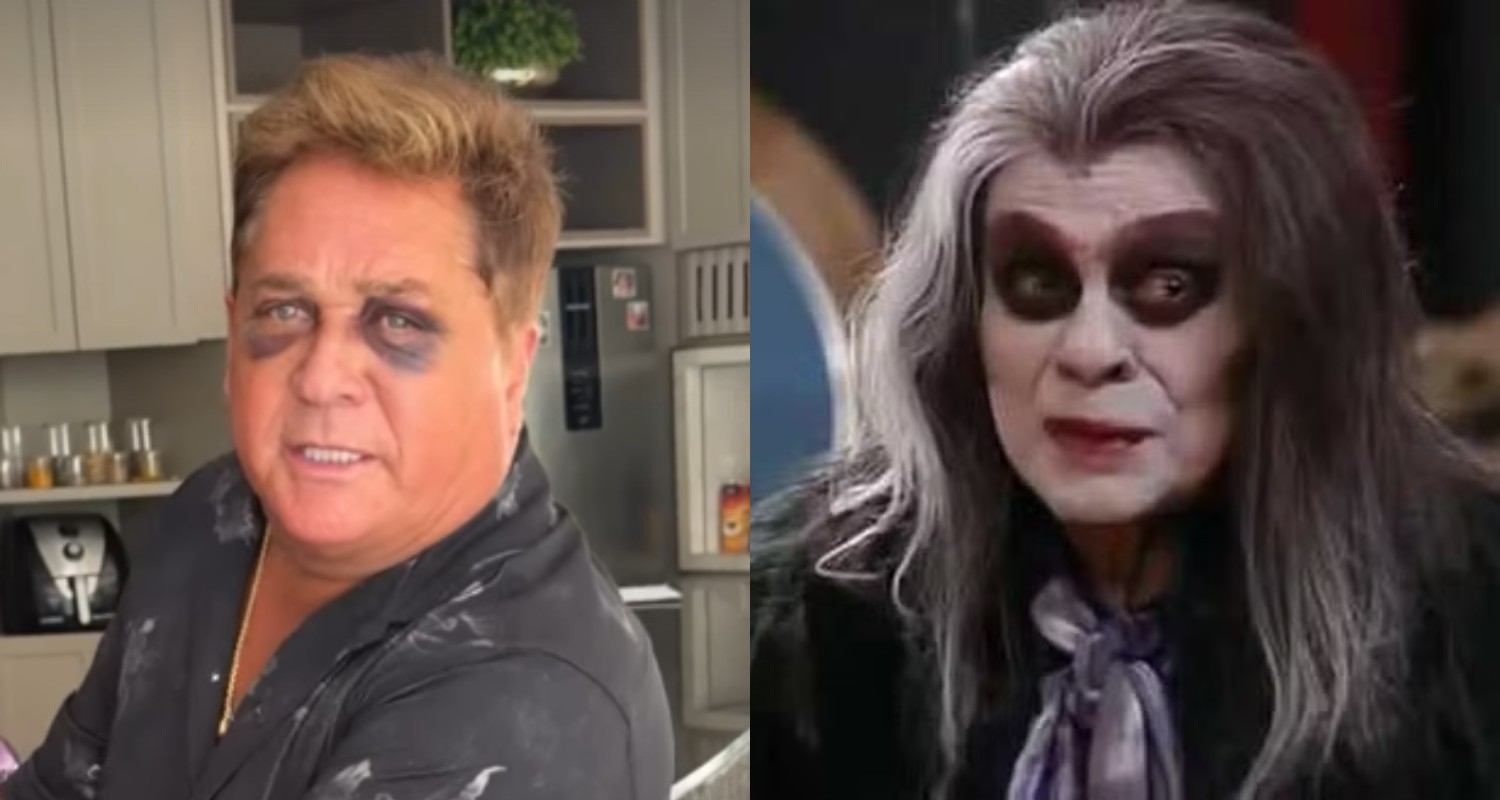 Após sofrer acidente, Leonardo faz piada com olho roxo: 'Bento Carneiro, o vampiro brasileiro'
