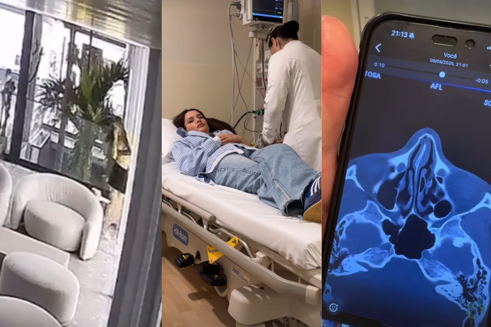 Juliette sofre fratura após bater cabeça em porta — Foto: Instagram