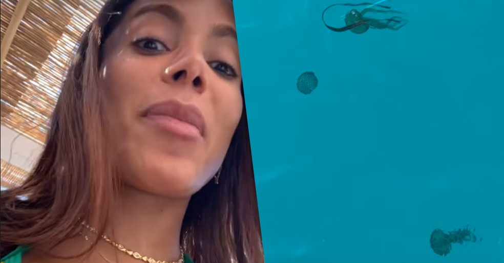 Anitta mostra como é a medusa, água-viva que a queimou em Ibiza: 'Aí a  demônia que me pegou' | Famosos | gshow