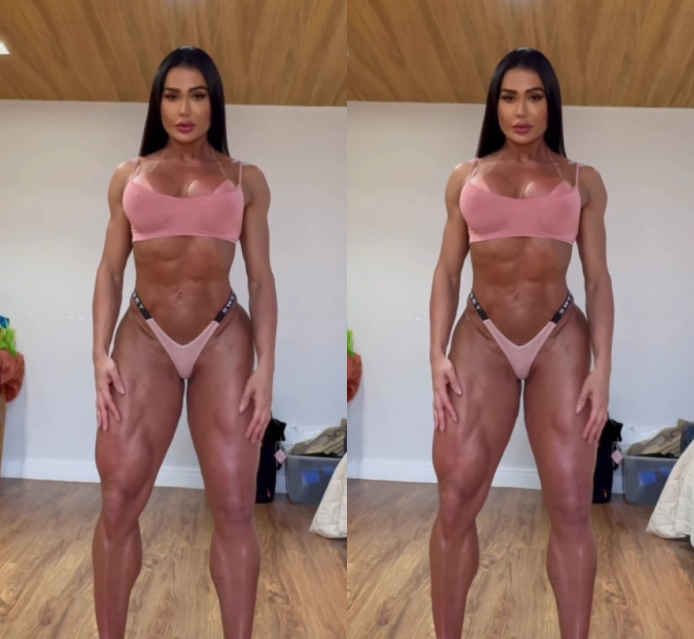 Ex-BBB Gracyanne Barnosa desabafa sobre diferença entre suas pernas após lesão — Foto: Reprodução/Redes sociais