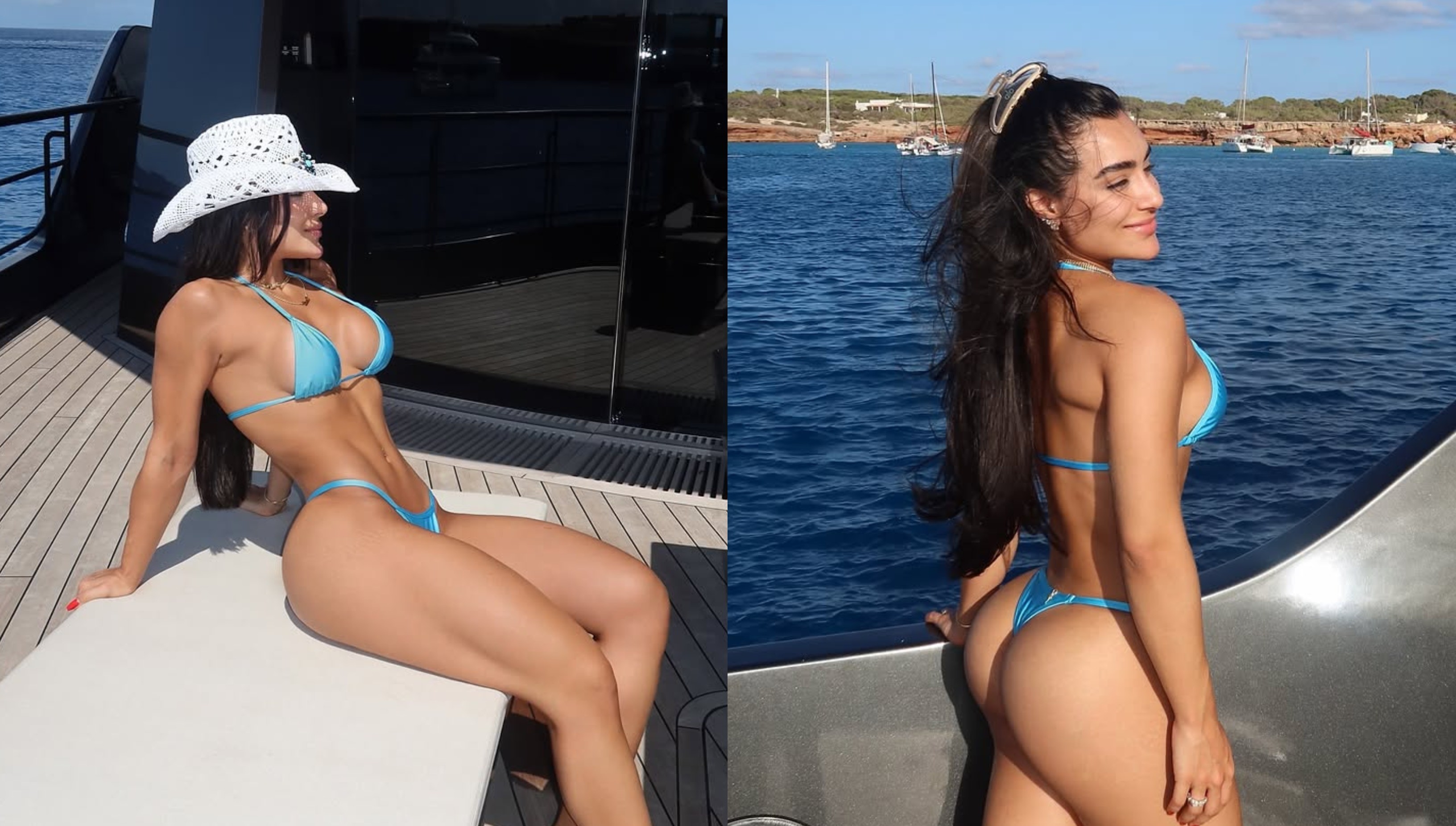 Duda Freire em biquíni mostrando resultado da harmonização no bumbum em Ibiza