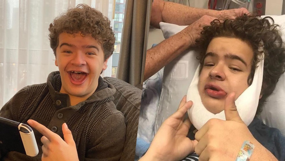 Gaten Matarazzo é portador de uma doença rara que afeta os ossos — Foto: Reprodução/Instagram