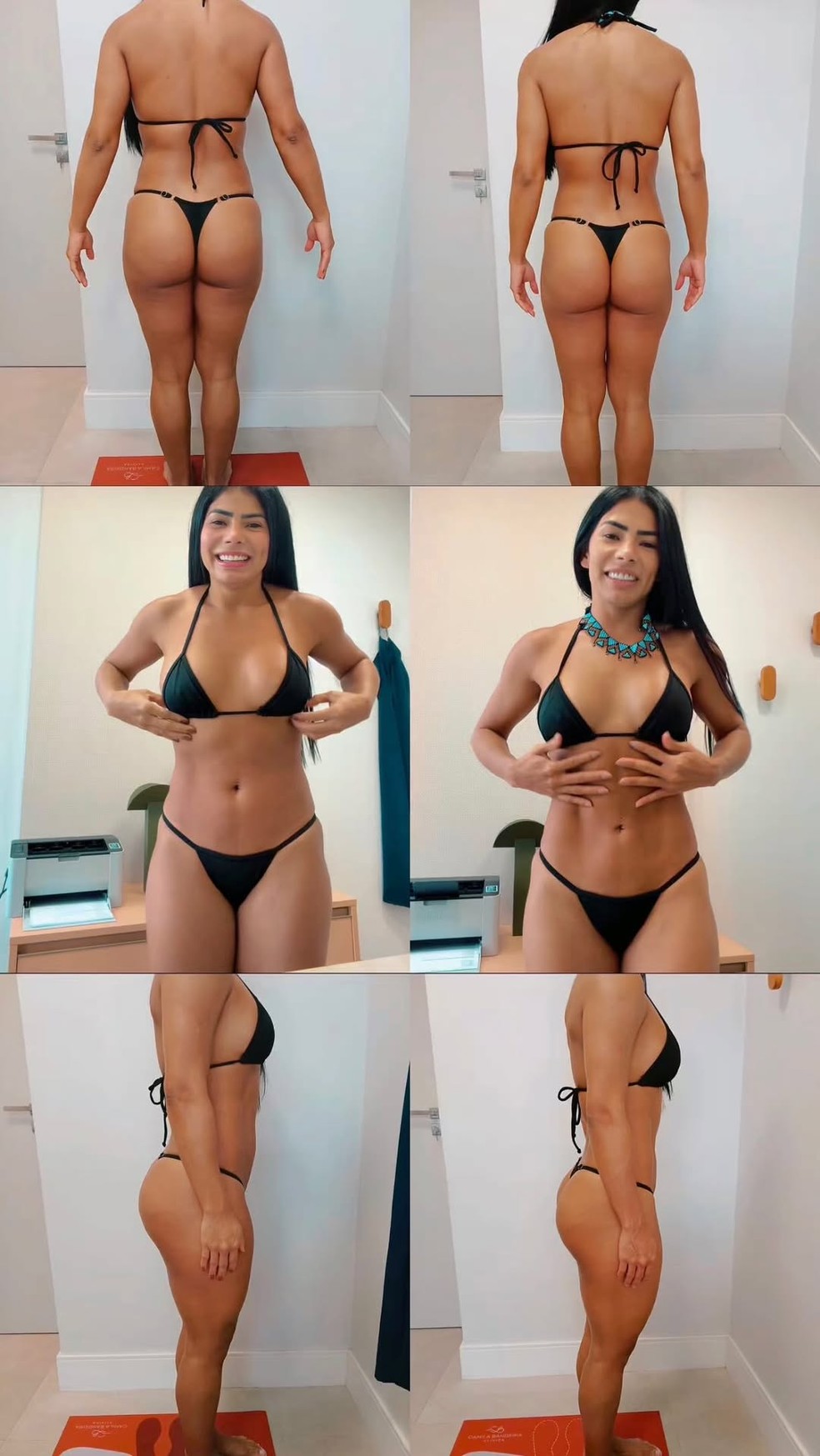 Marciele mostra antes e depois — Foto: Reprodução