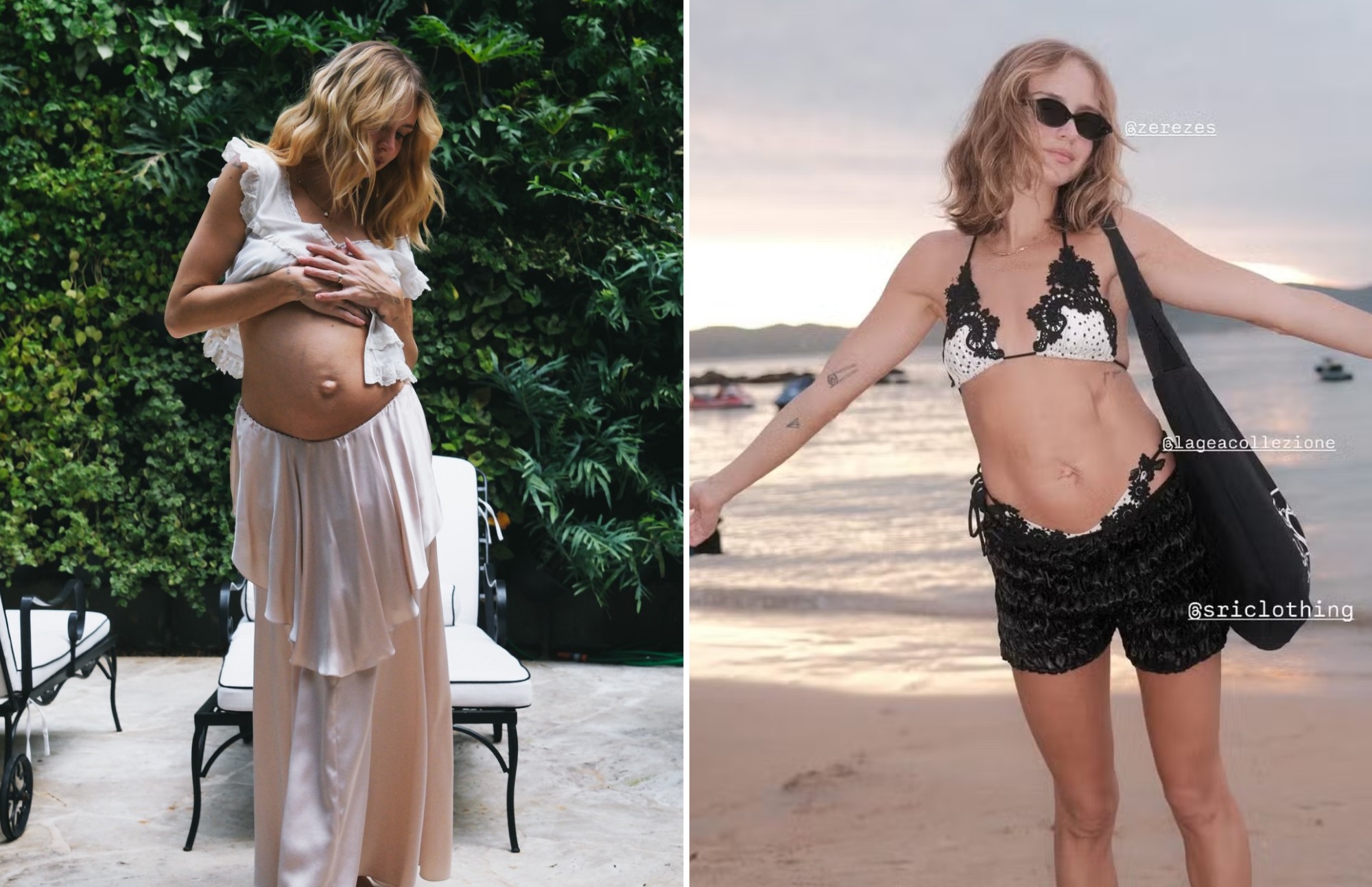 Isa Scherer conta que vai operar diástase abdominal e hérnia umbilical após gravidez; entenda