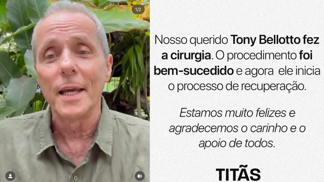 Com câncer, Tony Bellotto passa por cirurgia: ‘Procedimento foi bem-sucedido’, diz nota