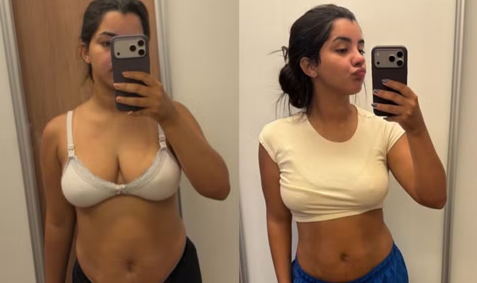 Antes e depois de Ary Mirelle &mdash; Foto: Instagram