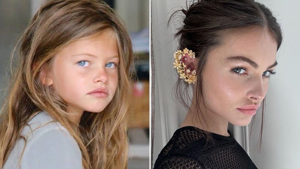 Veja o antes e depois da 'menina mais bonita do mundo' — Foto: Reprodução/Instagram