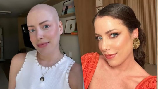 Em tratamento contra o câncer, Fabiana Justus reflete sobre estar careca e queda de cabelo: 'Hoje é a minha menor preocupação' - Foto: (Instagram)