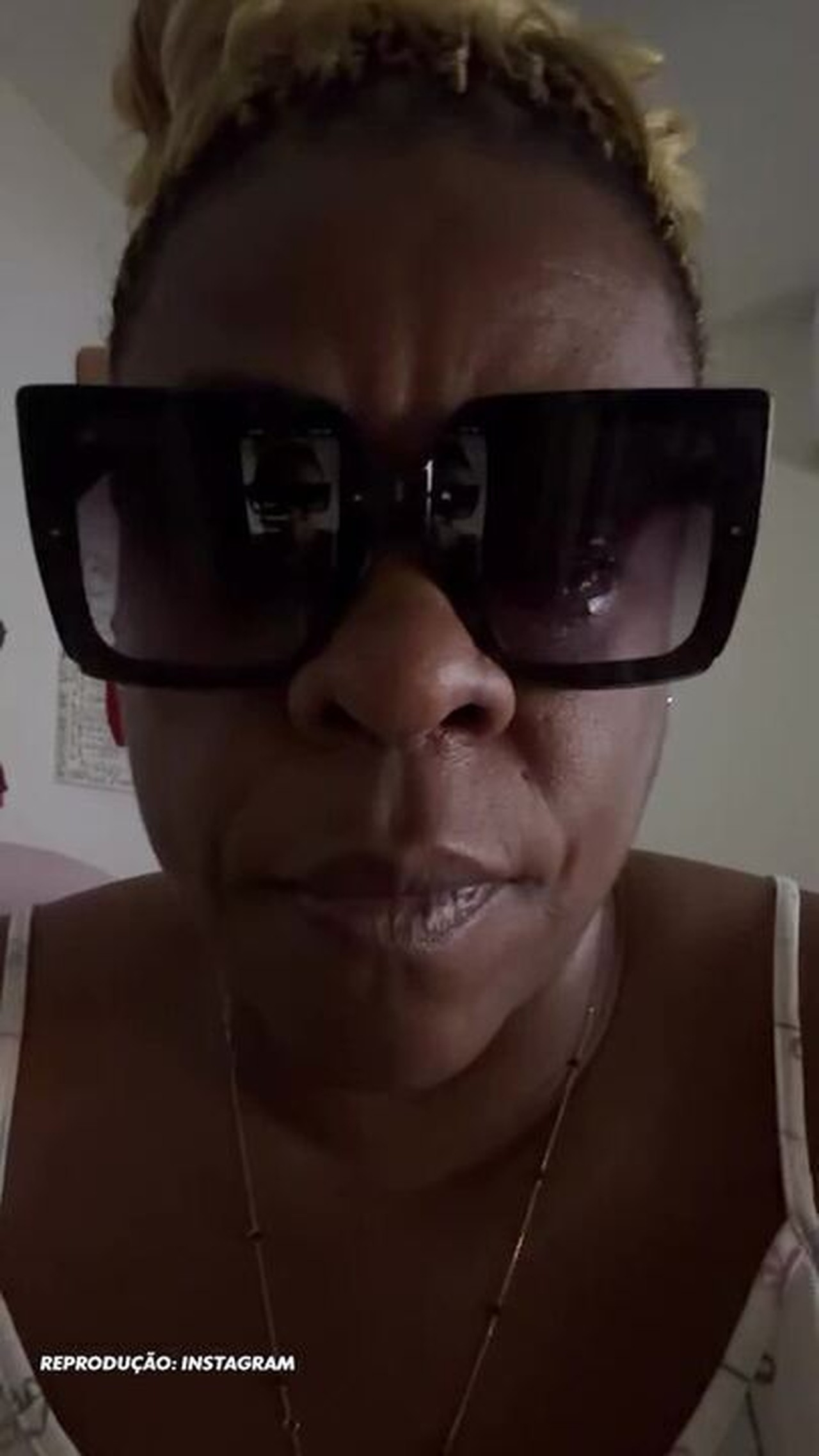 Após perda temporária da visão, Cacau Protásio faz apelo: 'Não usem pomada'