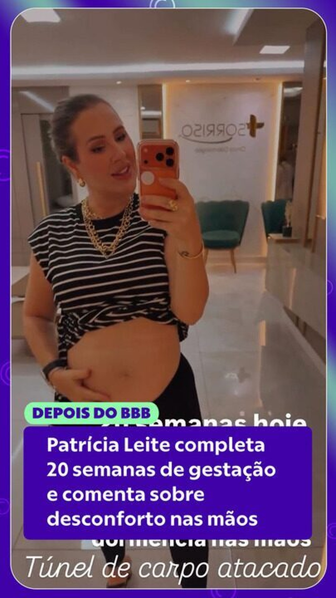 Patrícia Leitte completa 20 semanas de gestação e comenta desconforto nas mãos