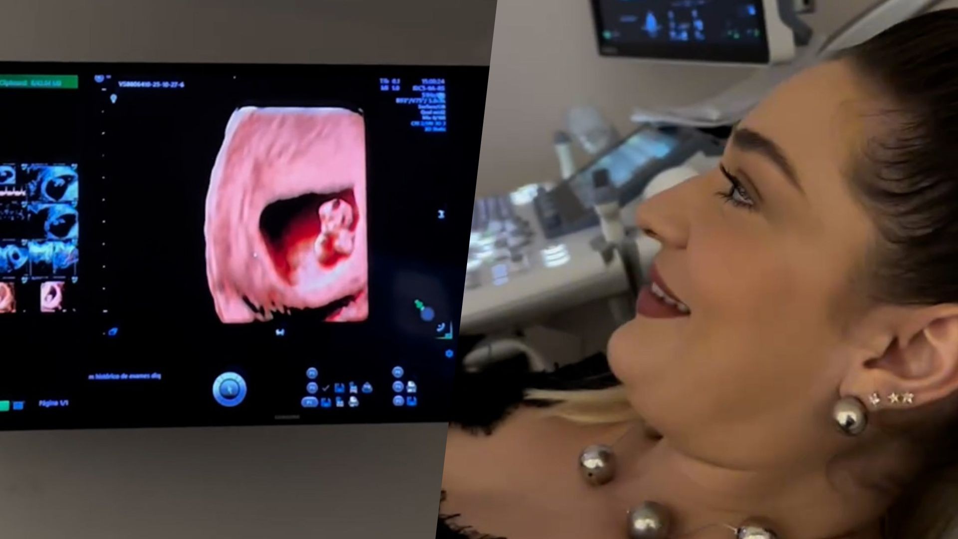 Ex-BBB Marília Miranda faz primeira ultra do bebê e se surpreende com possível data de nascimento