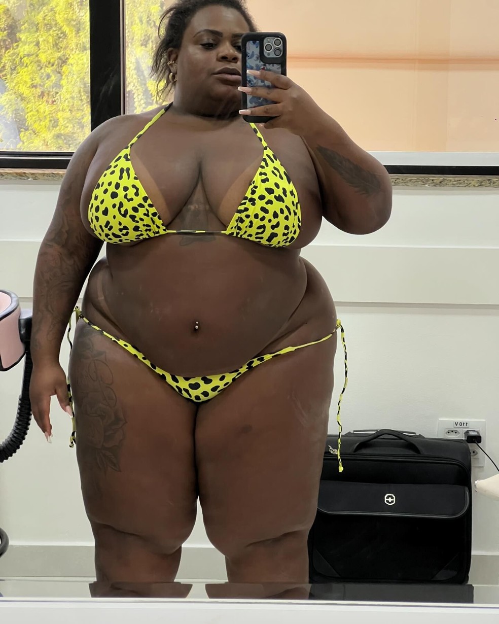 Jojo Todynho posta antes e depois da cirurgia bariátrica — Foto: Instagram