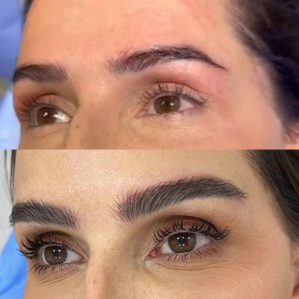 Sobrancelhas de Deborah Secco antes e depois do transplante — Foto: Divulgação