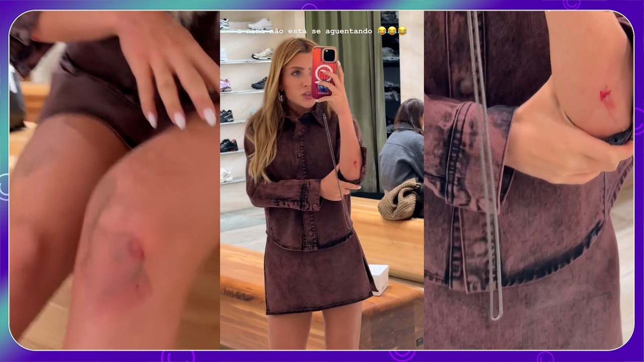 Jade Picon mostra machucados de tombo que levou em Los Angeles: 'Patinei no asfalto'