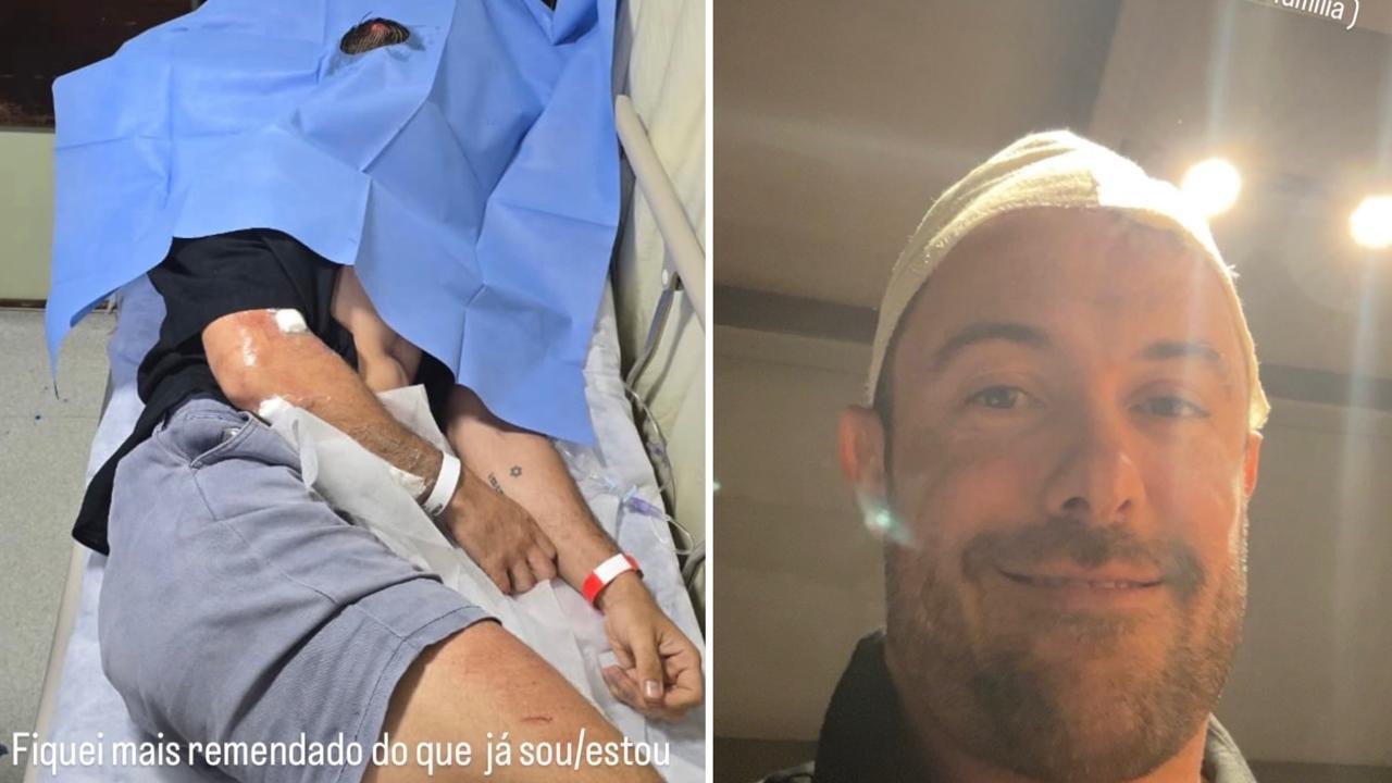 Após acidente de bicicleta, Kayky Brito atualiza estado de saúde e reconhece: 'Errei de estar sem capacete'