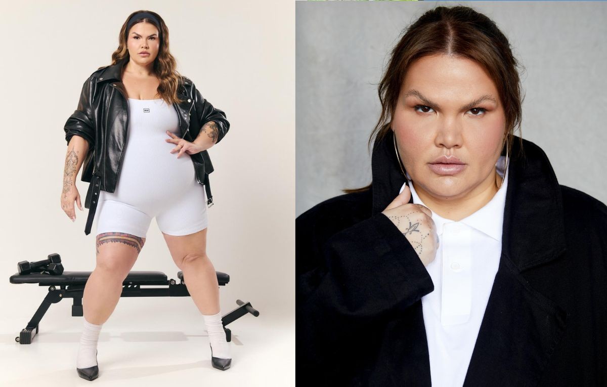 Com 108 Kg, após eliminar 90, Thais Carla planeja cirurgia reparadora para retirar excesso de pele