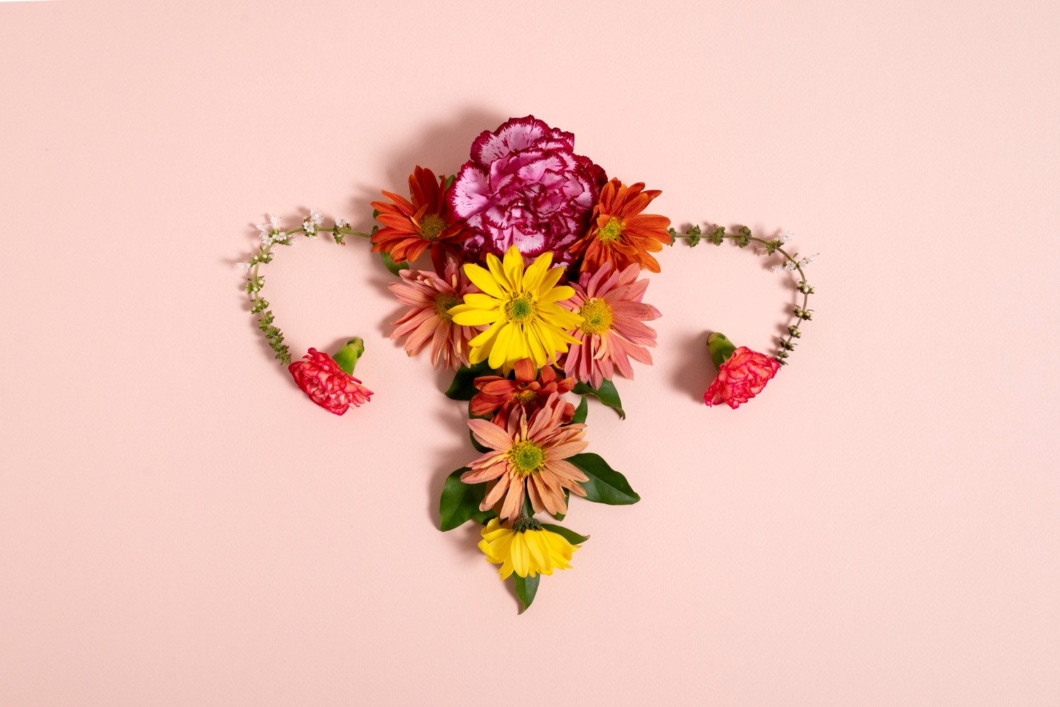 O que é histerectomia? Entenda quando a cirurgia de retirada do útero é indicada