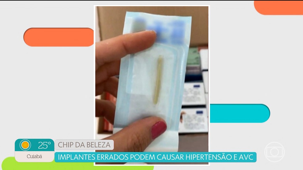 Chip da beleza pode causar hipertensão e até mesmo AVC — Foto: Reprodução: TV Globo