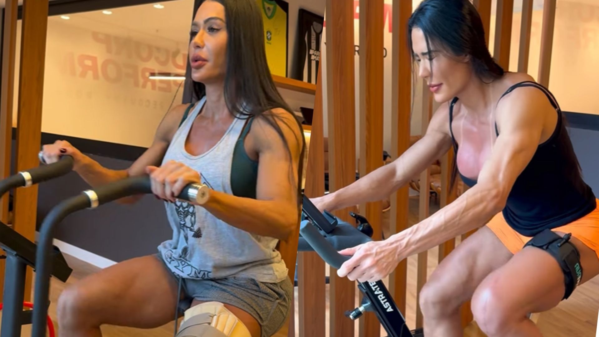 Gracyanne Barbosa mostra evolução na bicicleta após cirurgia no joelho: 'Superando as dores'