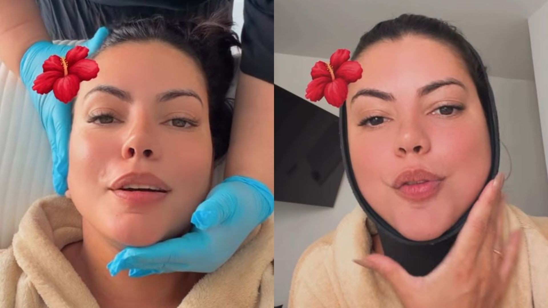 Fernanda Bande atualiza pós-operatório e revela vontade de refazer cirurgia no nariz