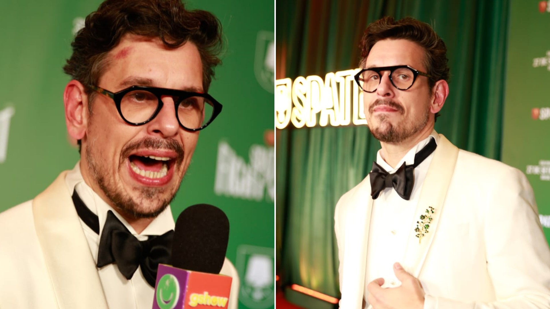 João Vicente de Castro aparece em evento de luta com hematoma na testa e brinca sobre desafiar Chay Suede