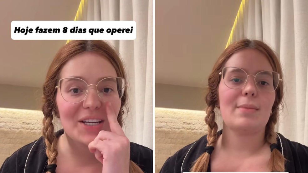 Viih Tube faz cirurgias plásticas — Foto: Reprodução/Instagram