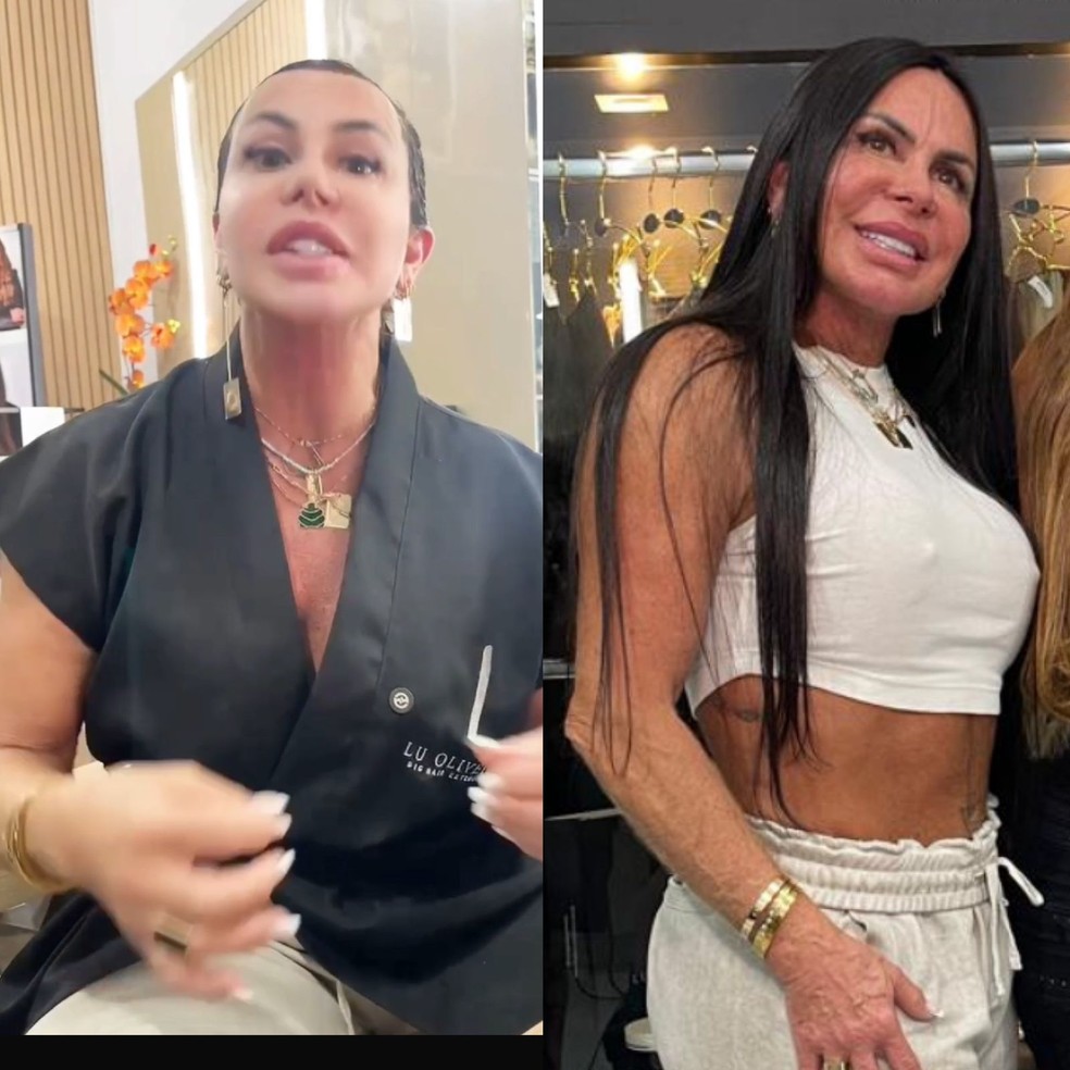 Gretchen exalta autoestima após falar de alopecia e mostrar queda capilar:  'Se amem e não se importem' | Famosos | gshow