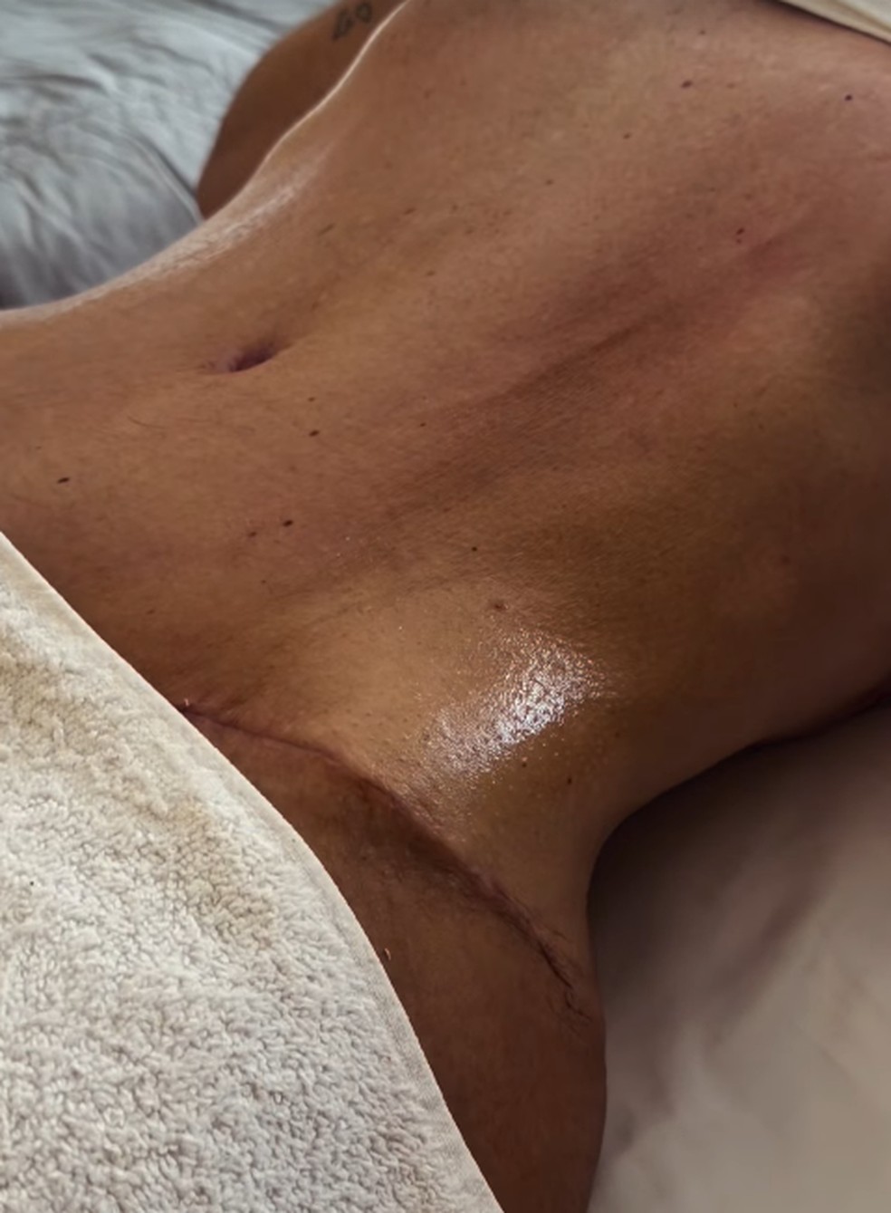 Margareth Serrão, mãe de Virginia, impressiona com resultado de cirurgia plástica — Foto: Reprodução do Instagram