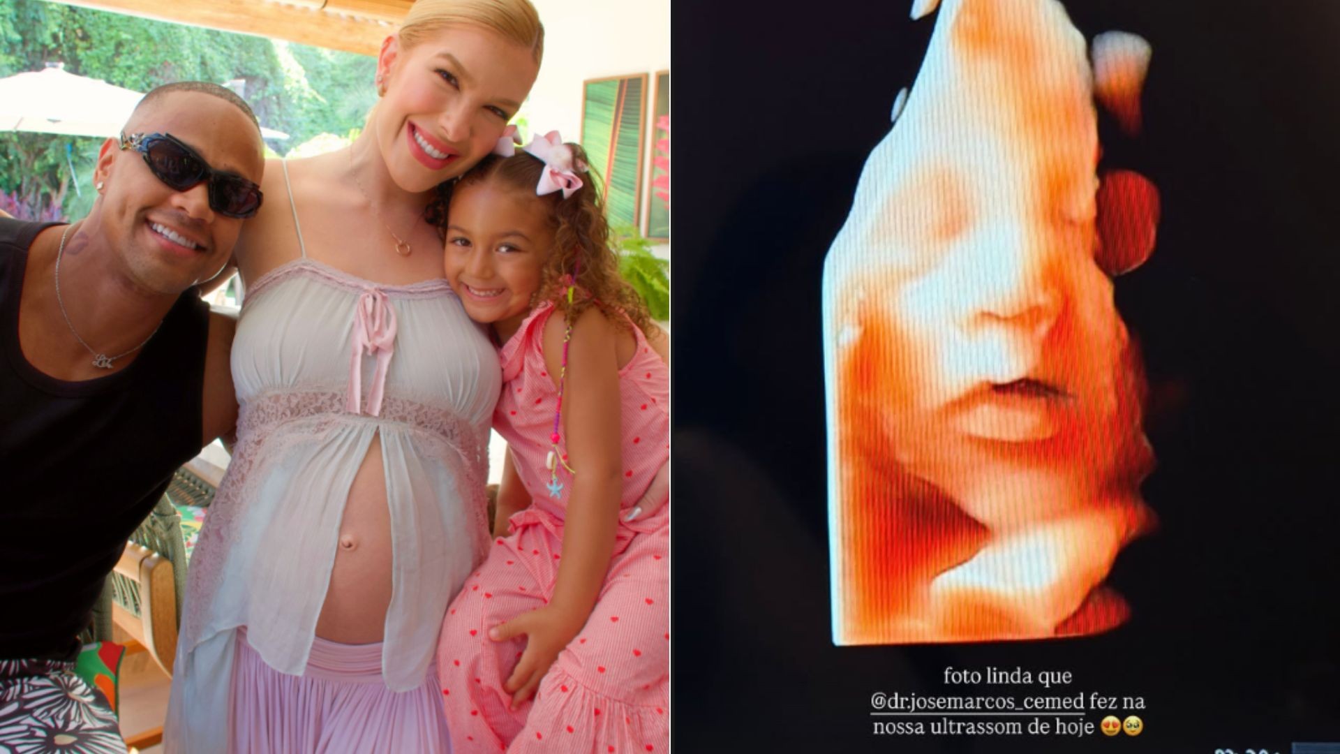 Lore Improta mostra o rosto do filho em ultrassom e se derrete: 'A cara do papai'