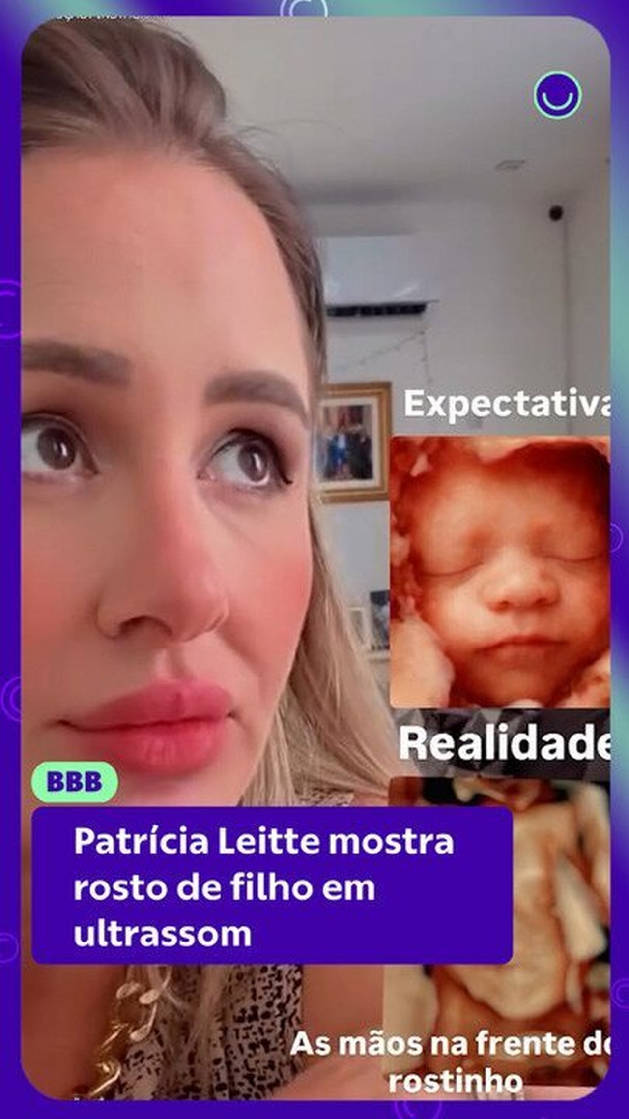 Patrícia Leitte mostra o rosto do filho em ultrassom e relata dificuldade durante o exame