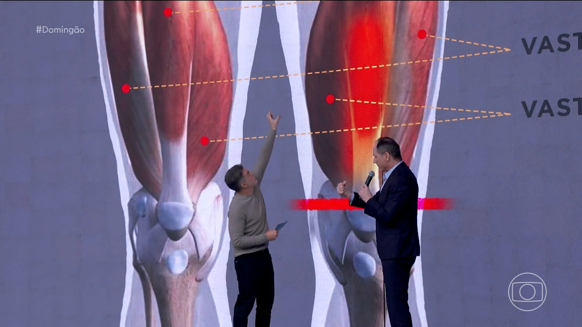 O que aconteceu com Gracyanne Barbosa? Especialista explica lesão