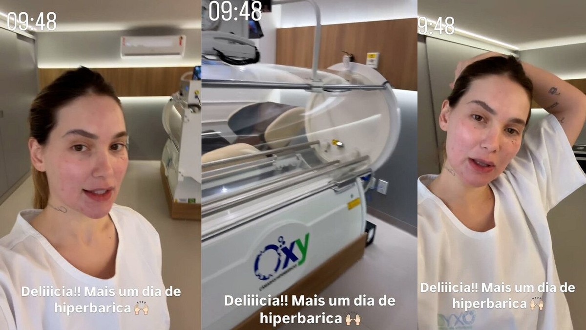 Câmara hiperbárica: saiba tudo sobre o tratamento escolhido por ...
